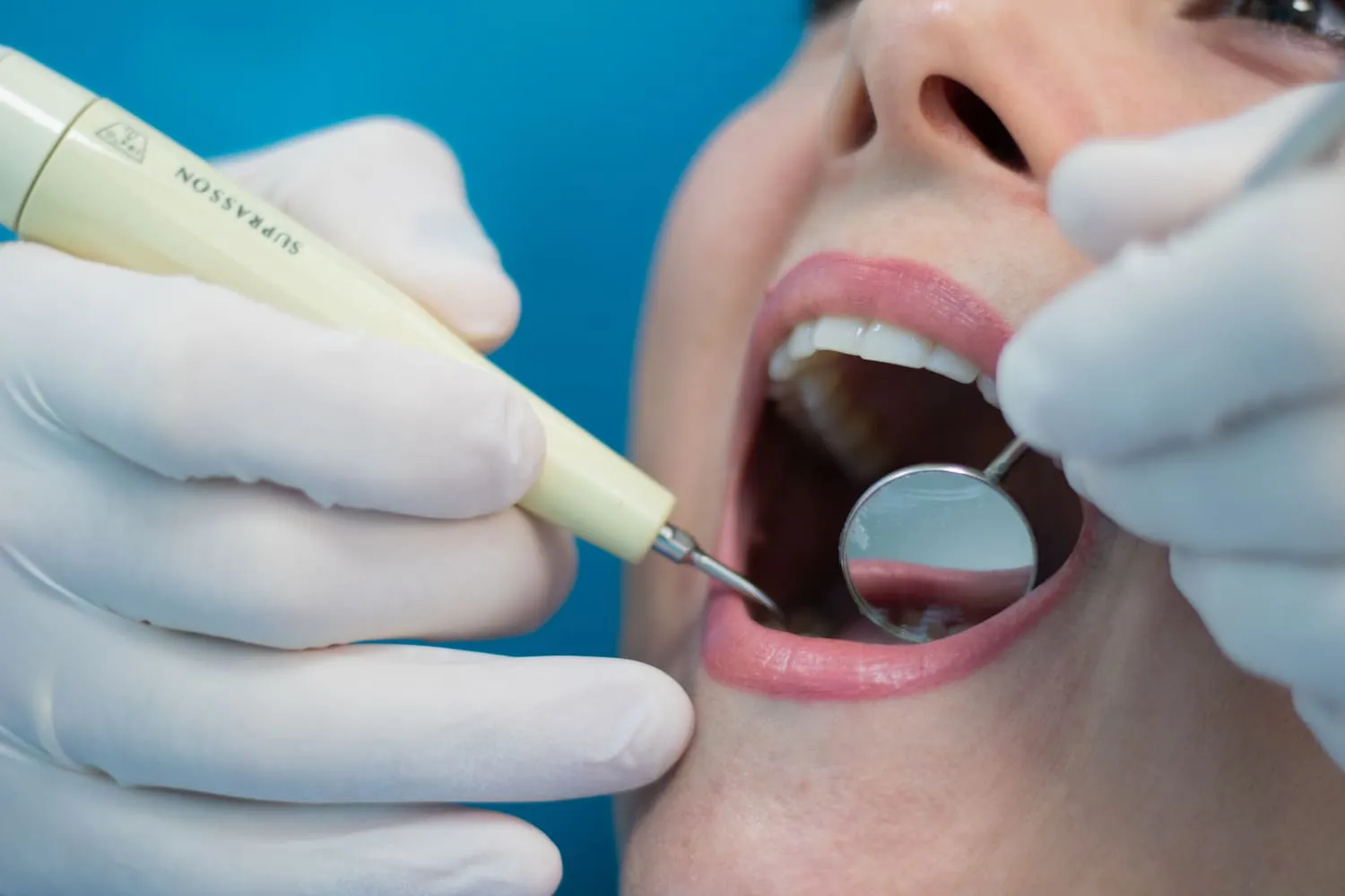 Valoración dental en Dentaláser