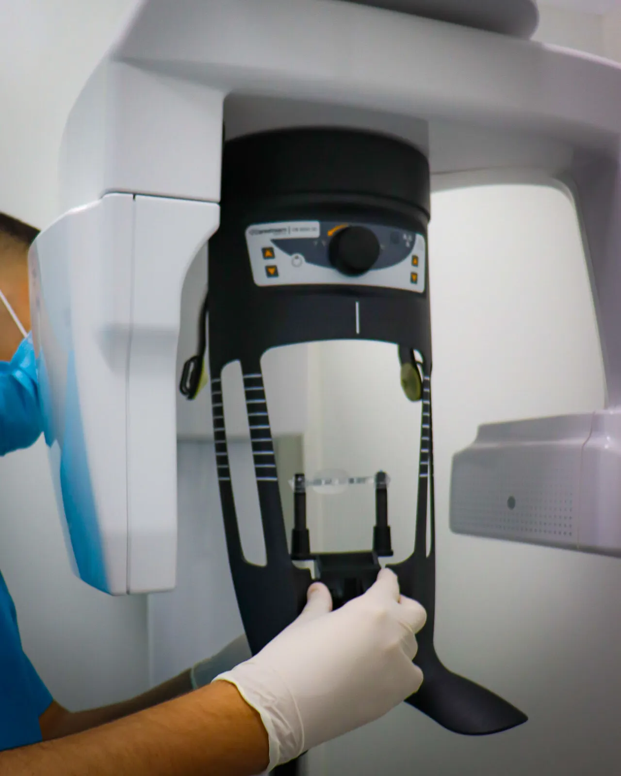 All-on-Six implantes completos Dentaláser