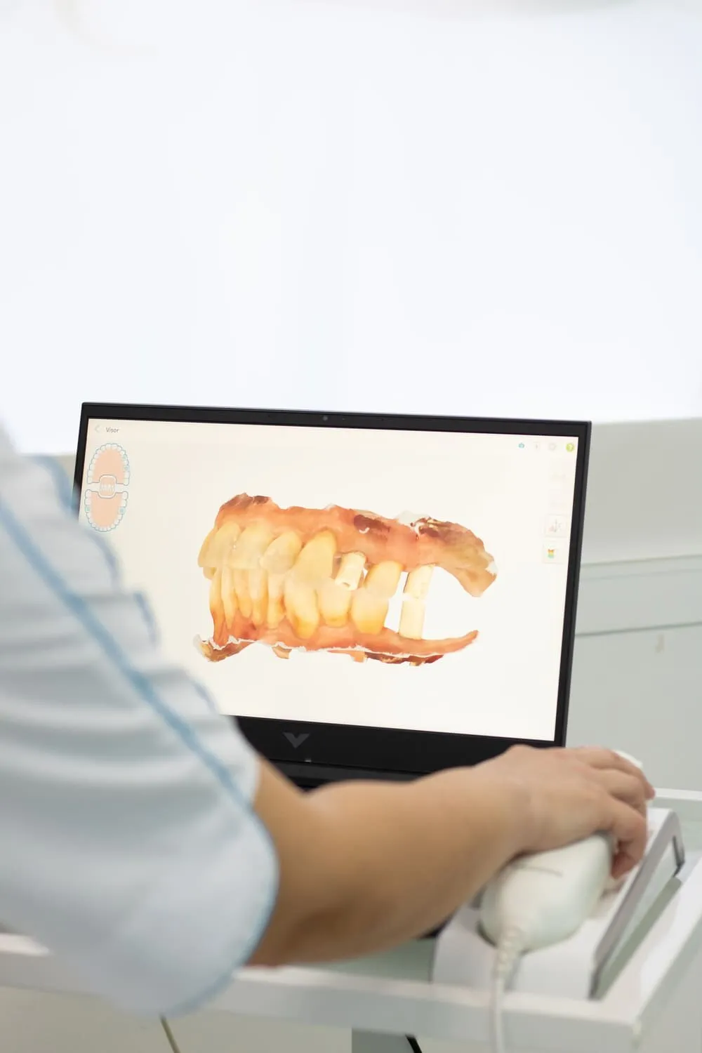 Diseño digital de sonrisa Dentaláser