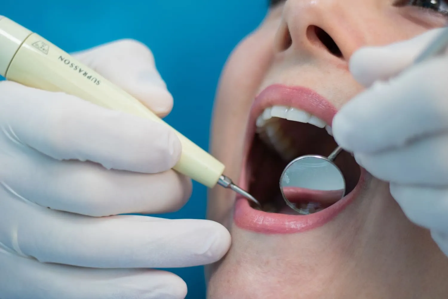 Higienista de Dentaláser mostrando la técnica de cepillado adecuada tras la colocación de un implante