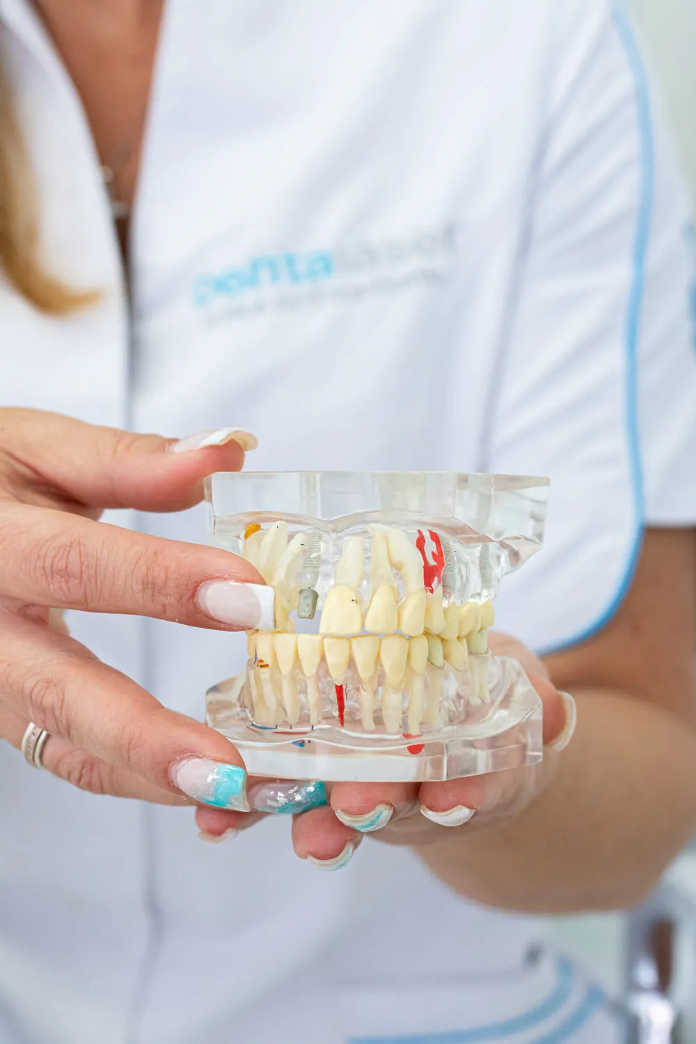 Implante unitario Dentaláser